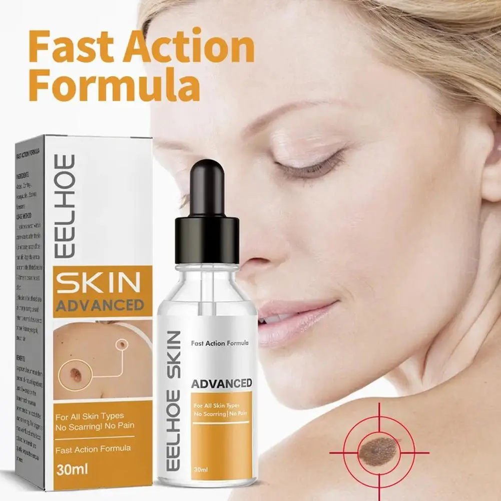 30ml Wart Removal Essence Skin Cleansing Meat Thorns Painless Wart Removal Hands Feet Corns Flat Plantar Warts Body Care
30ml Wart Removal Essence Skin Cleansing Meat Thorns Painless Wart Removal Hands Feet Corns Flat Plantar Warts Body Care