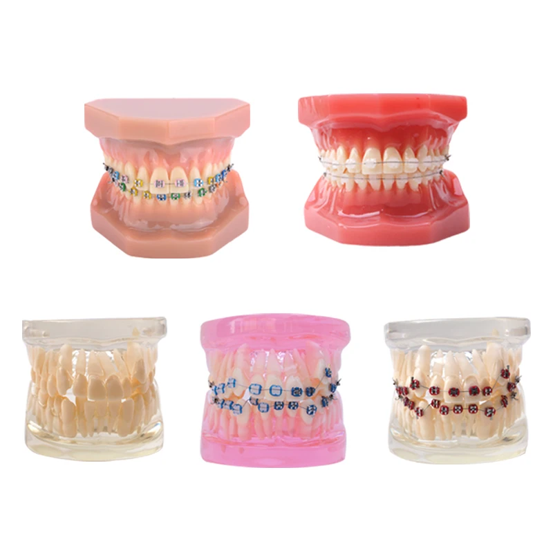 Dental Teeth Model Ortho Ceramic Bracket Model Orthodontic Ceramic Bracket Model Education Demonstration Tool Dental Materials 
Dental Teeth Model Ortho Ceramic Bracket Model Orthodontic Ceramic Bracket Model Education Demonstration Tool Dental Materials