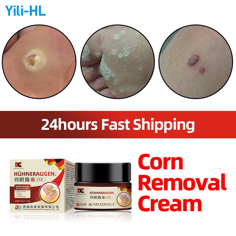 Corn Removal Cream Wart Calluses Callosity Plantar Warts Remover Foot Corns Treatment Medicine Feet Care German Secret Recipe
Corn Removal Cream Wart Calluses Callosity Plantar Warts Remover Foot Corns Treatment Medicine Feet Care German Secret Recipe