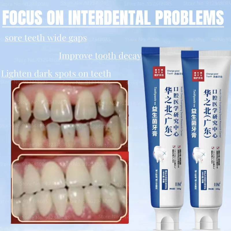 Быстрое восстановление полости, кариеса, наполнение, удаление зубного налета, пятен, кариес, отбеливание, пожелтение, ремонт отбеливания зу...
Быстрое восстановление полости, кариеса, наполнение, удаление зубного налета, пятен, кариес, отбеливание, пожелтение, ремонт отбеливания зу...