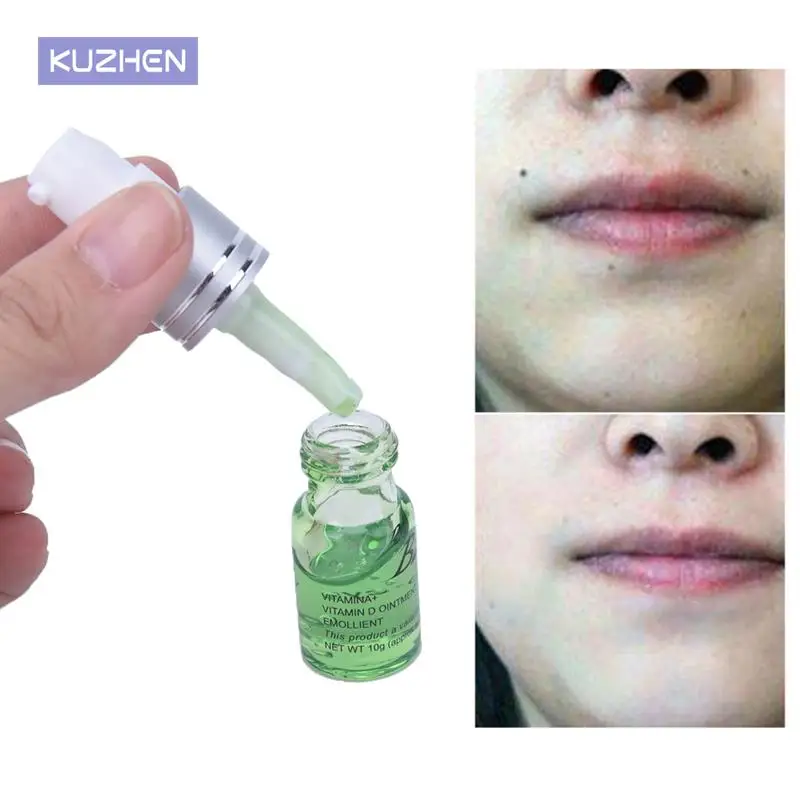 Mole & Skin Tag Repair Solution Painless Mole Skin Dark Spot Repair Face Wart Tag Freckle Repair Cream Oil New Arrival
Mole & Skin Tag Repair Solution Painless Mole Skin Dark Spot Repair Face Wart Tag Freckle Repair Cream Oil New Arrival