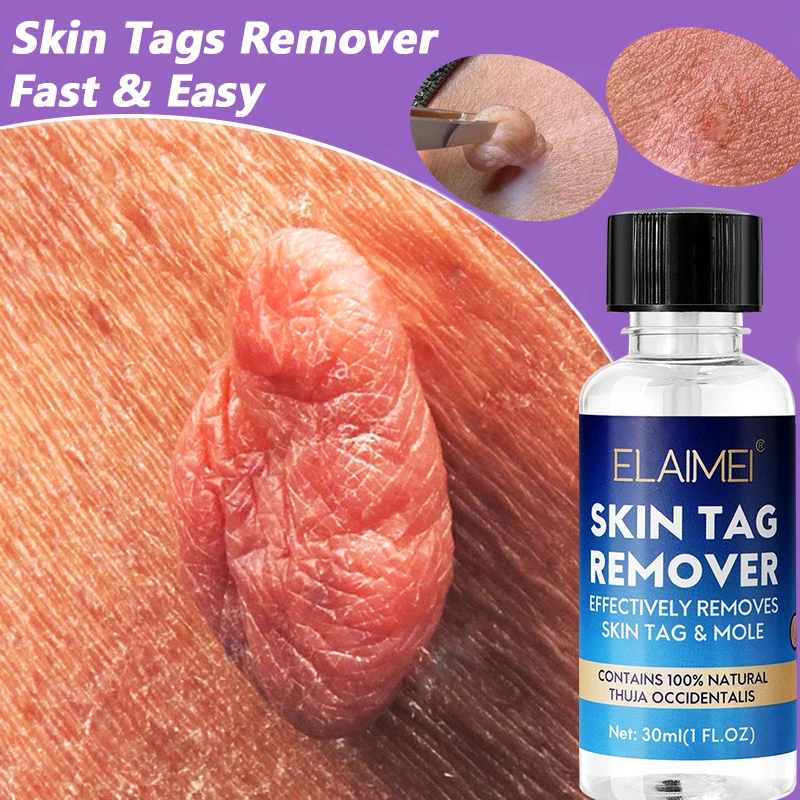 30Ml Organic Tags Solutions Serum Natural Skin Tag Treatment Liquid Painless Wart Mole Corn Removal For Face Body Skin Care
30Ml Organic Tags Solutions Serum Natural Skin Tag Treatment Liquid Painless Wart Mole Corn Removal For Face Body Skin Care
