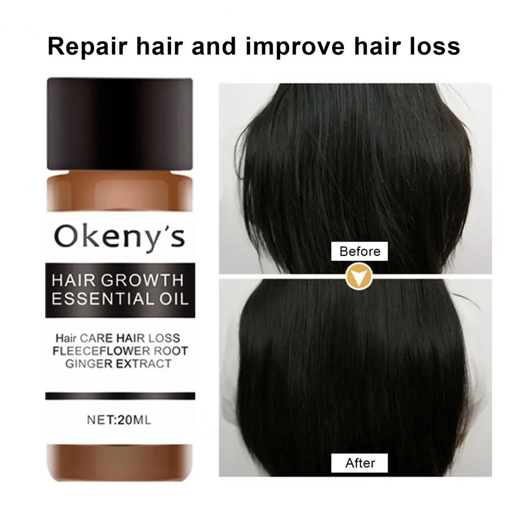 20ml Hair Growth Conditioner Long Lifespan Moisturizing Safe Hair Care Essential Oil for Men
20ml Hair Growth Conditioner Long Lifespan Moisturizing Safe Hair Care Essential Oil for Men