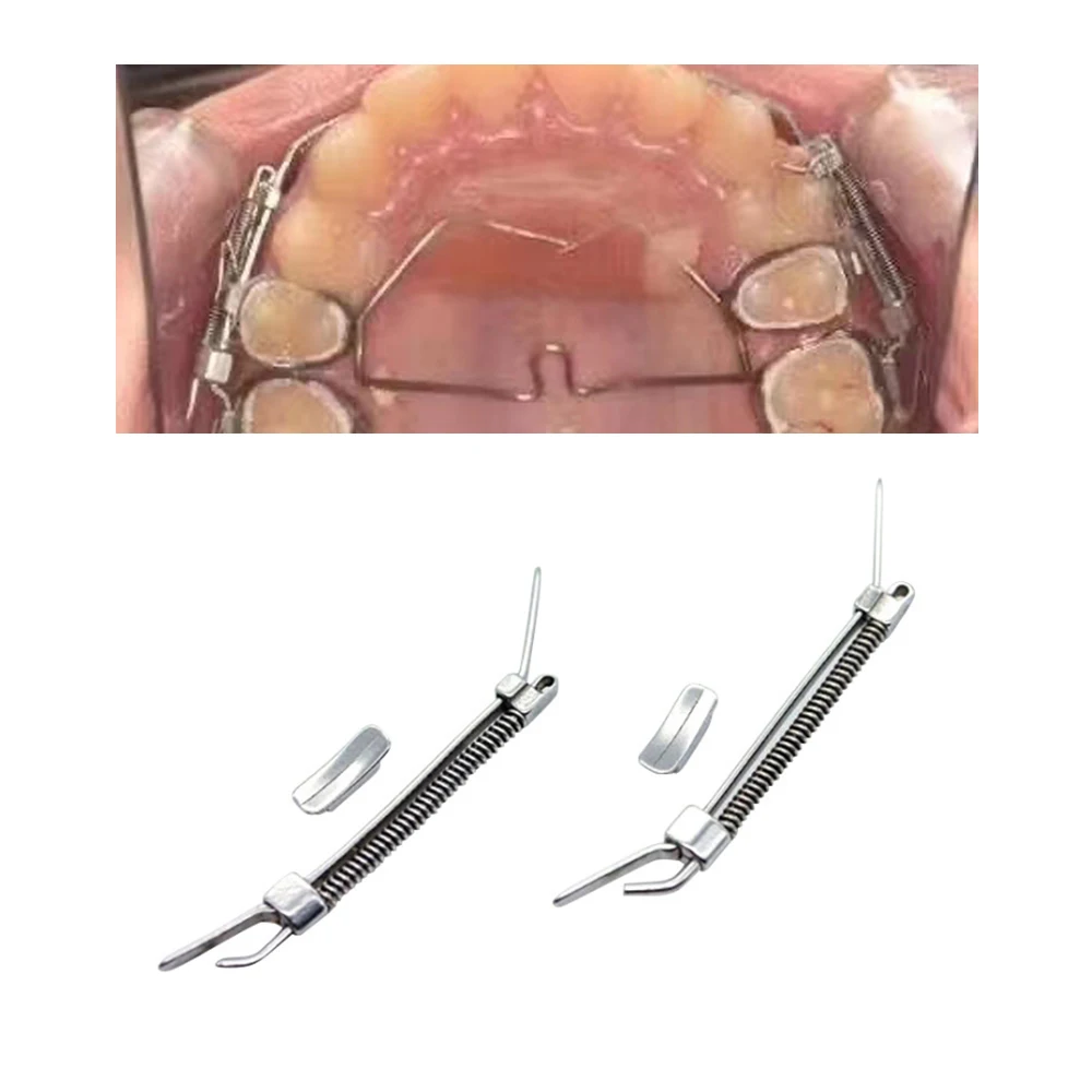 2Pcs/Pack Dental Orthodontic Molar Pusher Orthodontic Molar Distalizing Distalizer Molar Propeller Expansion Spring Tooth Pusher
2Pcs/Pack Dental Orthodontic Molar Pusher Orthodontic Molar Distalizing Distalizer Molar Propeller Expansion Spring Tooth Pusher