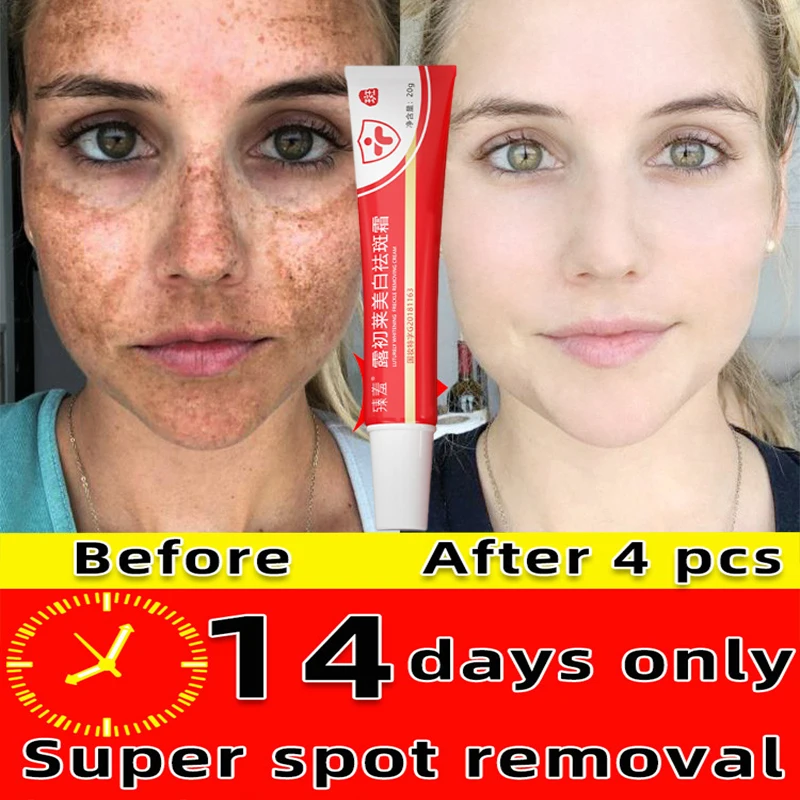 Niacinamide Whitening Freckles Face Cream Fade Spot Melasma Melanin Pimple Firming Anti-Aging Brightening Moisturizing Skin Care
Niacinamide Whitening Freckles Face Cream Fade Spot Melasma Melanin Pimple Firming Anti-Aging Brightening Moisturizing Skin Care