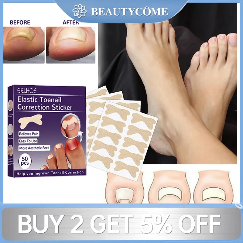 50pcs Nail Correction Patches Ingrown Nail Correction Patches Paronychia Treatment Elastic Patches Waterproof Pedicure Tools
50pcs Nail Correction Patches Ingrown Nail Correction Patches Paronychia Treatment Elastic Patches Waterproof Pedicure Tools