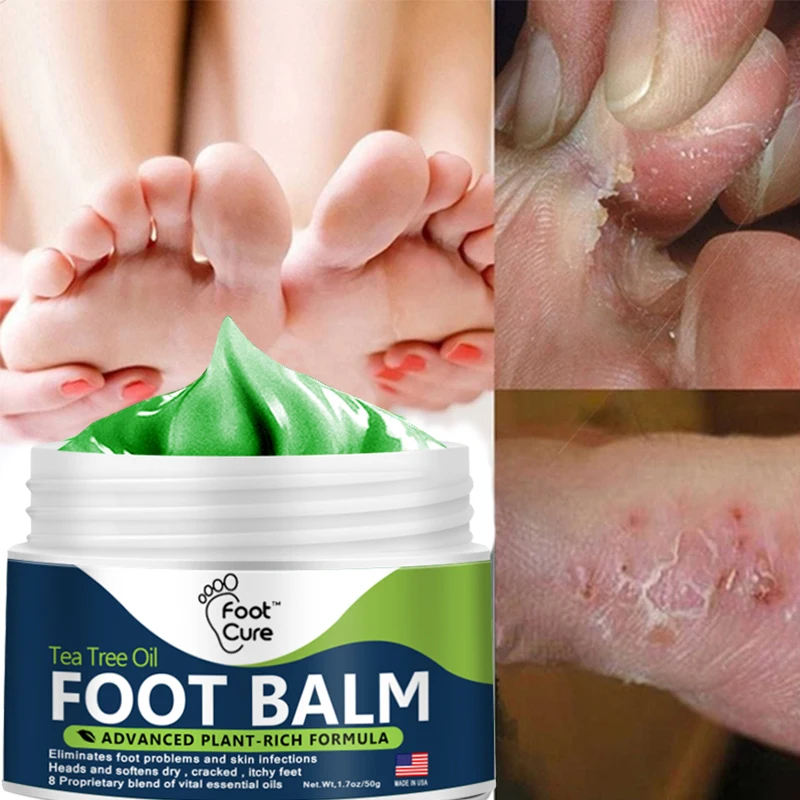 Anti-Drying Crack Foot Cream Heel Cracked Repair Cream Removal Dead Skin Hand Feet Care Hand and Foot Skin Care Foot Peel 15/50g
Anti-Drying Crack Foot Cream Heel Cracked Repair Cream Removal Dead Skin Hand Feet Care Hand and Foot Skin Care Foot Peel 15/50g