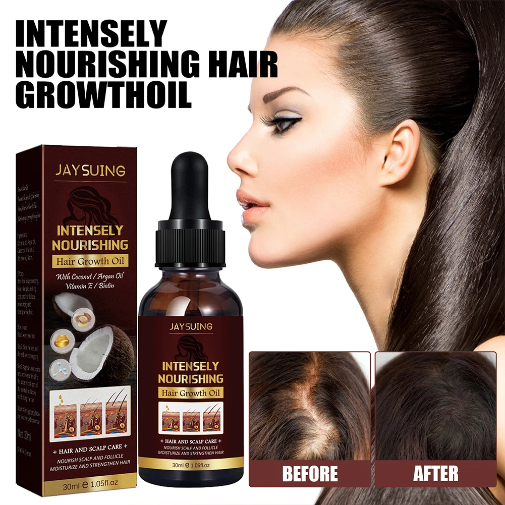 Кокосовое масло для роста волос, увлажняющая Женская сыворотка, натуральное ежедневное использование, повышает прочность для ухода за кожей головы, 30 мл
Кокосовое масло для роста волос, увлажняющая Женская сыворотка, натуральное ежедневное использование, повышает прочность для ухода за кожей головы, 30 мл