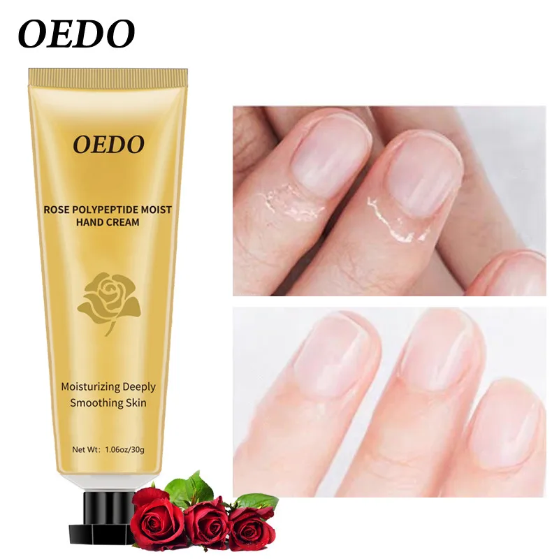Skin Dry Care Repair Soften Whitening Non-greasy Anti-Aging Natural Super Rose Polypeptide Moisturzing Hand Cream
Skin Dry Care Repair Soften Whitening Non-greasy Anti-Aging Natural Super Rose Polypeptide Moisturzing Hand Cream