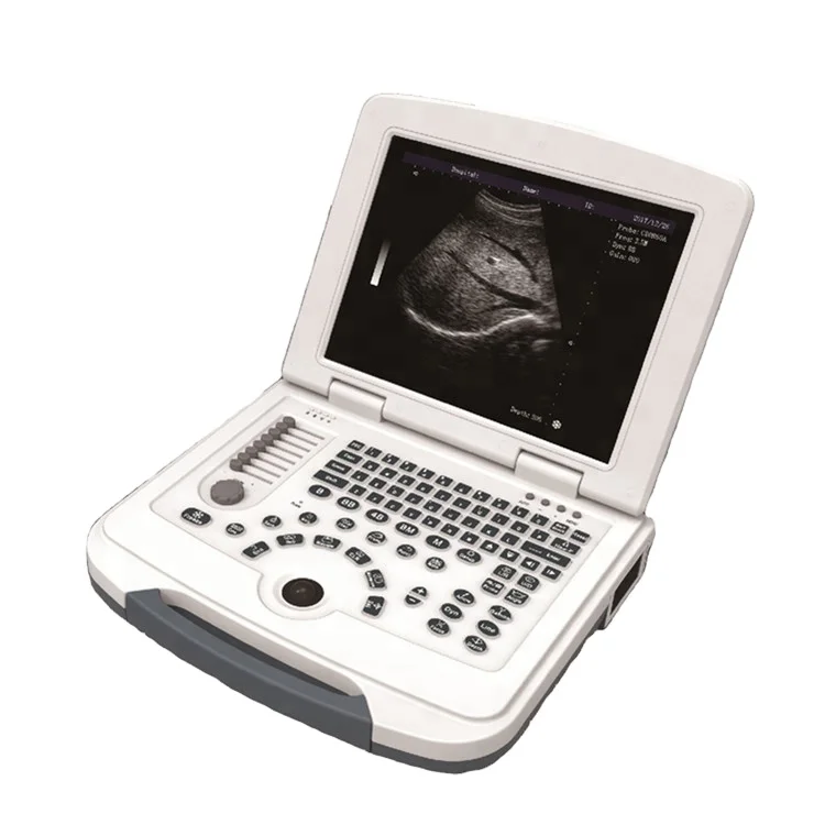 BT-UD580 Hospital B/W Ultrasound Instruments Portable Medical Ultrasound Scanner Machine
BT-UD580 Hospital B/W Ultrasound Instruments Portable Medical Ultrasound Scanner Machine
