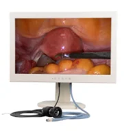 1080P Full HD Endoscope Camera Unit: Medical Monitor, Medical Endoscope HD Camera and Medical LED Light Source
1080P Full HD Endoscope Camera Unit: Medical Monitor, Medical Endoscope HD Camera and Medical LED Light Source