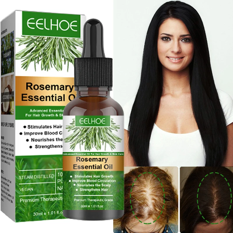 Sdotter Rosemary Essential Oil Biotin Hairs Growing Product Faster Anti Prevent Loss Damaged Repair Alopecia Treatment Scalp Car
Sdotter Rosemary Essential Oil Biotin Hairs Growing Product Faster Anti Prevent Loss Damaged Repair Alopecia Treatment Scalp Car