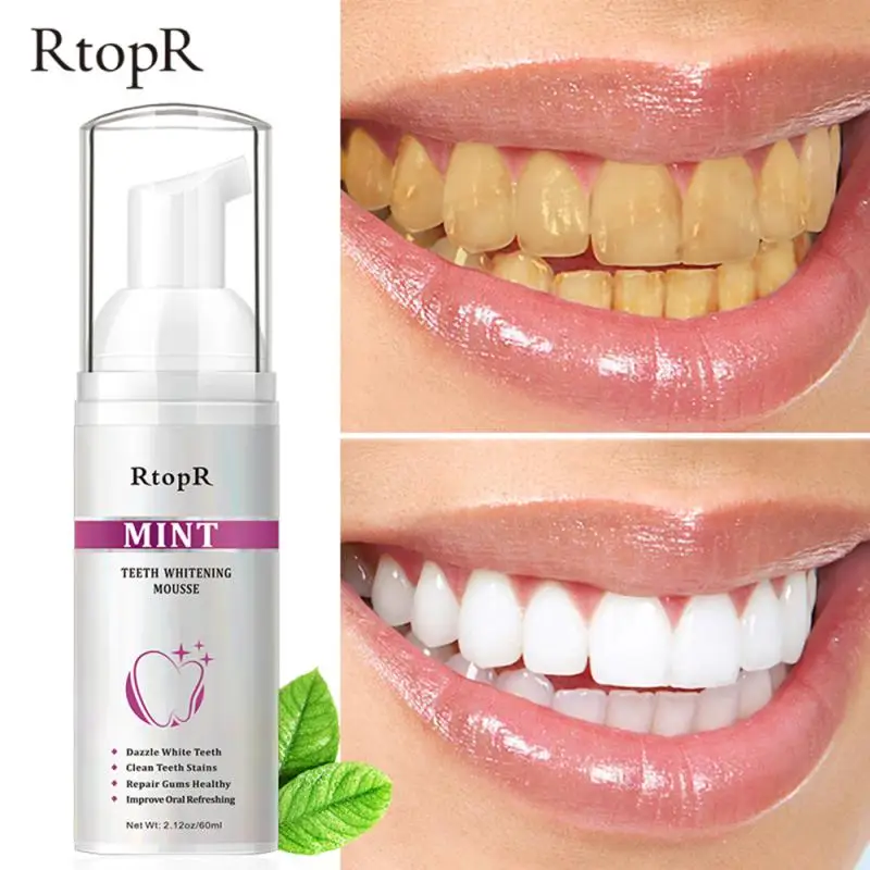 RtopR Mint Tooth Whitenging Mousse Oral Cleaning Whitening Teeth Plaque Stains Removal Remove Odor Oral Refreshing Whiten Teeth
RtopR Mint Tooth Whitenging Mousse Oral Cleaning Whitening Teeth Plaque Stains Removal Remove Odor Oral Refreshing Whiten Teeth