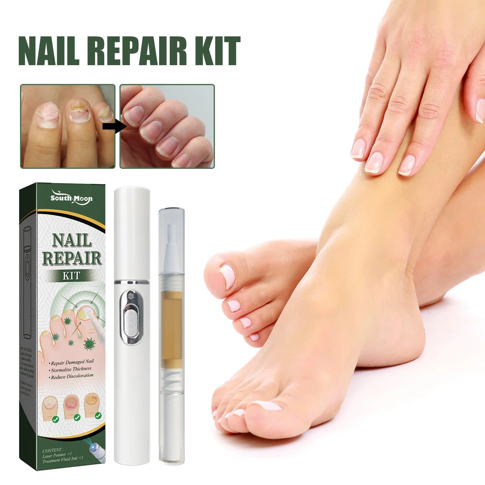 Nail Anti-fungal Repair Set Anti Fungus Treatment Serum And Nail Laser Pen Kit Onychomycosis Paronychia Anti Infection Nail Care
Nail Anti-fungal Repair Set Anti Fungus Treatment Serum And Nail Laser Pen Kit Onychomycosis Paronychia Anti Infection Nail Care