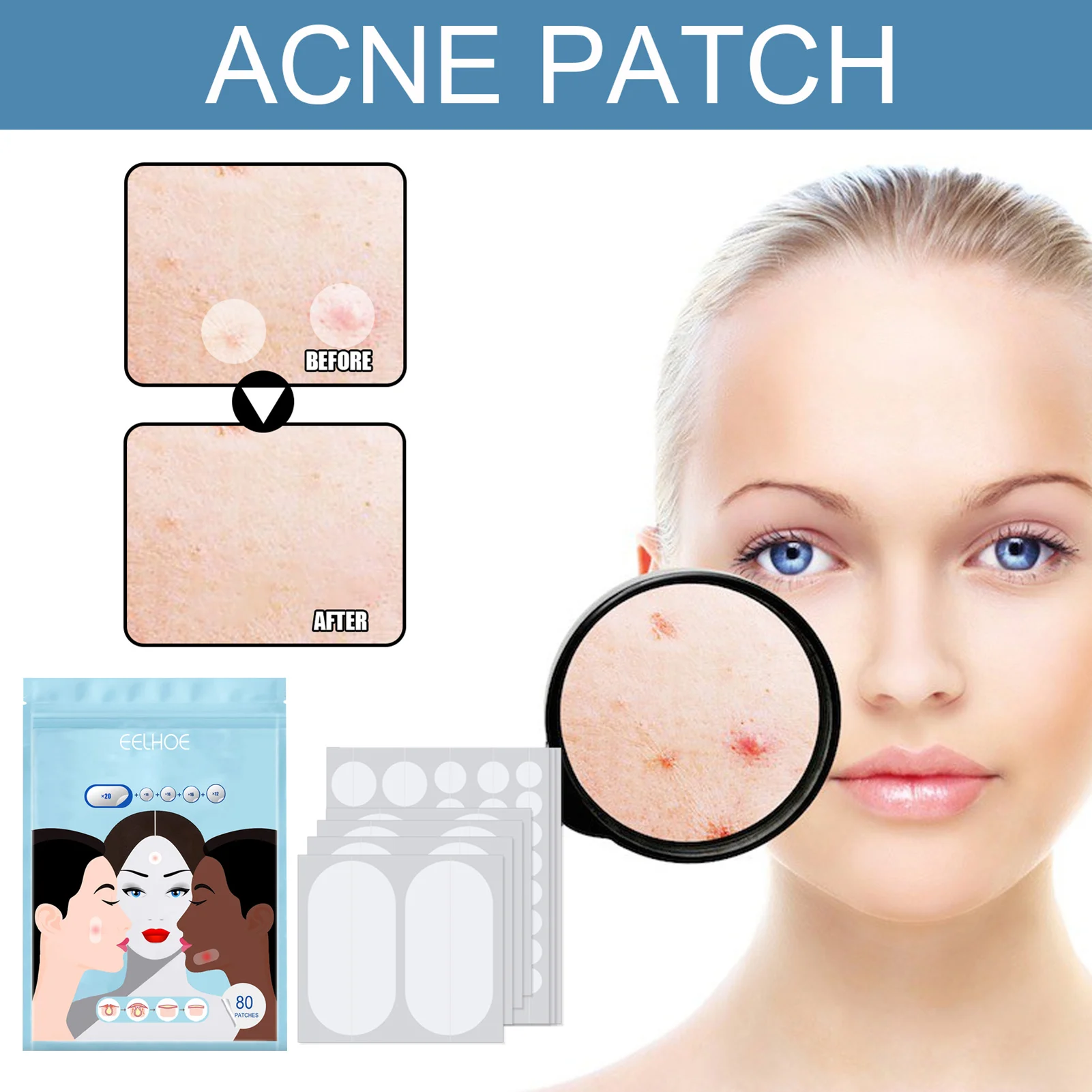 5 Sizes 80 Pcs/Set Hydrocolloid Bandages For Acnes Pimple Skin Zit Breakouts Removal Patches Removers Facial Chin Body Care
5 Sizes 80 Pcs/Set Hydrocolloid Bandages For Acnes Pimple Skin Zit Breakouts Removal Patches Removers Facial Chin Body Care