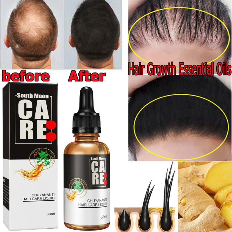 Ginger Hair Growth Products Essential Oil For Men Women Fast Regrowth Oil Hair Scalp Treatment Anti Hair Loss Beauty Health 30ml
Ginger Hair Growth Products Essential Oil For Men Women Fast Regrowth Oil Hair Scalp Treatment Anti Hair Loss Beauty Health 30ml