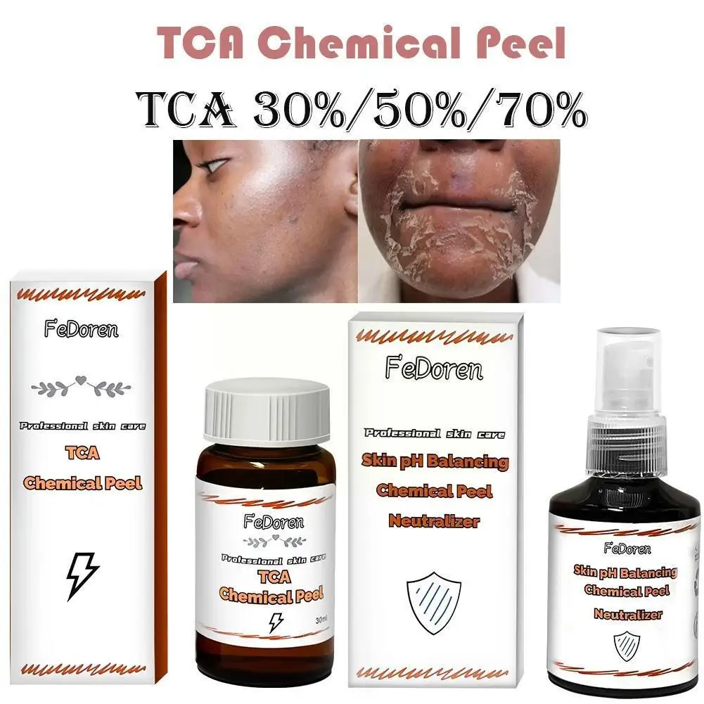 

30/50ml Chemical Peel 30% 50% 70% Acid Peeling Set Removes Neutralizer Dead Skin D9C7