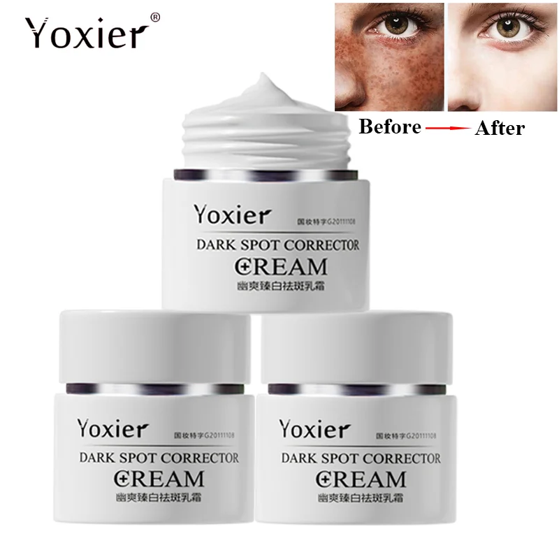 3PCS Dark Spot Remove Cream Face Skin Anti-Aging Bright Whitening Moisturizing Care Corrector Spots Sunburn Freckles Age Product
3PCS Dark Spot Remove Cream Face Skin Anti-Aging Bright Whitening Moisturizing Care Corrector Spots Sunburn Freckles Age Product