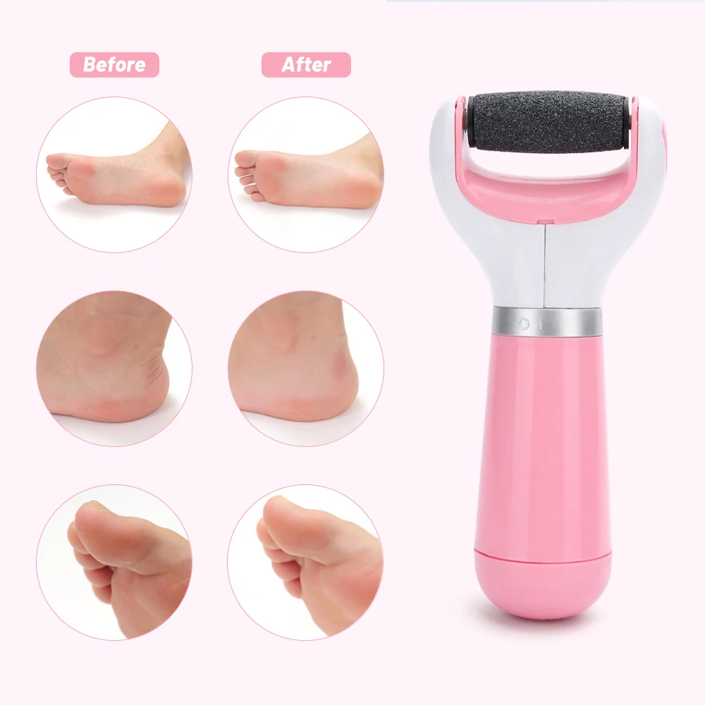 Electric Foot Grinder Professional Heel Peeling Pedicure Device USB Rechargeable Portable Pedicure Machine Home Personal Tool
Electric Foot Grinder Professional Heel Peeling Pedicure Device USB Rechargeable Portable Pedicure Machine Home Personal Tool