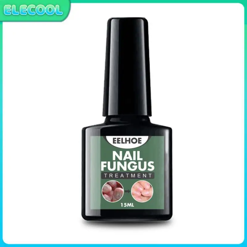 Жидкая лечебная ручка Eelhoe для восстановления ногтей, 15 мл, для онихомикоза, паронихии, утолщение ногтей от грибка, мягкий дизайн ногтей TSLM2 
Жидкая лечебная ручка Eelhoe для восстановления ногтей, 15 мл, для онихомикоза, паронихии, утолщение ногтей от грибка, мягкий дизайн ногтей TSLM2