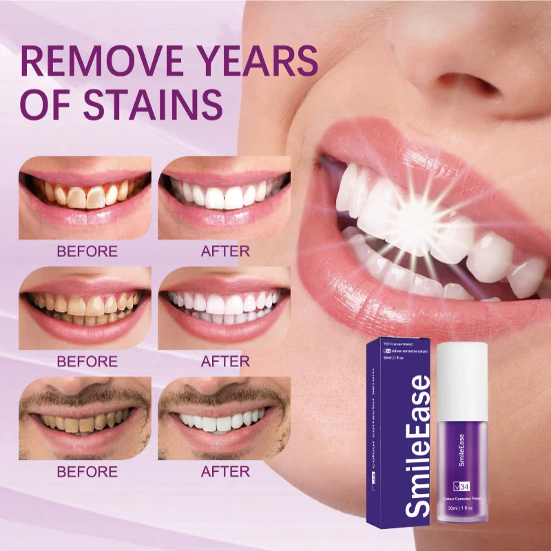 Teeth whitening toothpaste V34 purple bottle press-on toothpaste whitening mouth cleaning mousse toothpaste
Teeth whitening toothpaste V34 purple bottle press-on toothpaste whitening mouth cleaning mousse toothpaste