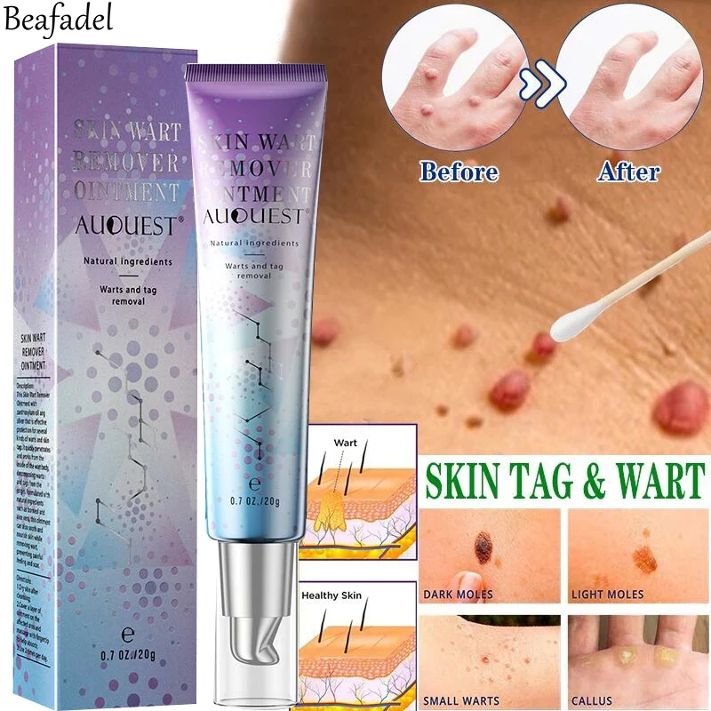 Genital Wart HPV Treatment and Warts Remover Plantar Cream Mite Mole Skin Tag Removal Skin Care Antibacterial Ointment 20g
Genital Wart HPV Treatment and Warts Remover Plantar Cream Mite Mole Skin Tag Removal Skin Care Antibacterial Ointment 20g