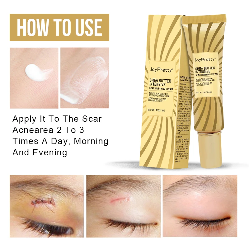 Scar Removal Cream Acne Pimple Mark Burn Scars Remover Mango Intensive Face Repair Enhance Elasticity Smooth Skin Care
Scar Removal Cream Acne Pimple Mark Burn Scars Remover Mango Intensive Face Repair Enhance Elasticity Smooth Skin Care