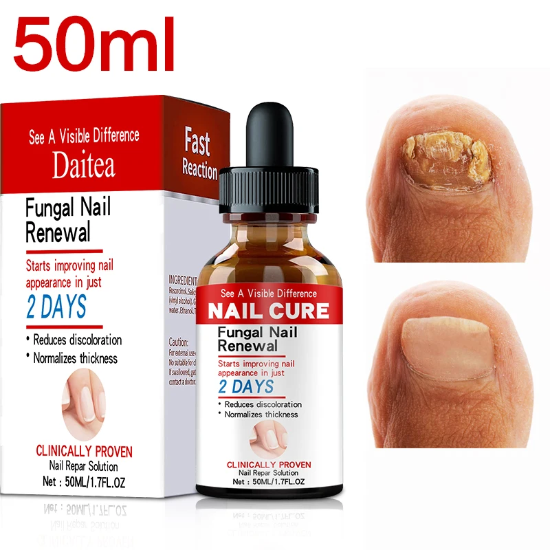7DAY Nail Fungus Treatment Serum Onychomycosis Paronychia Anti-Fungal Nails Infection Herbal Toe Fungal Foot Repair Essence Care
7DAY Nail Fungus Treatment Serum Onychomycosis Paronychia Anti-Fungal Nails Infection Herbal Toe Fungal Foot Repair Essence Care
