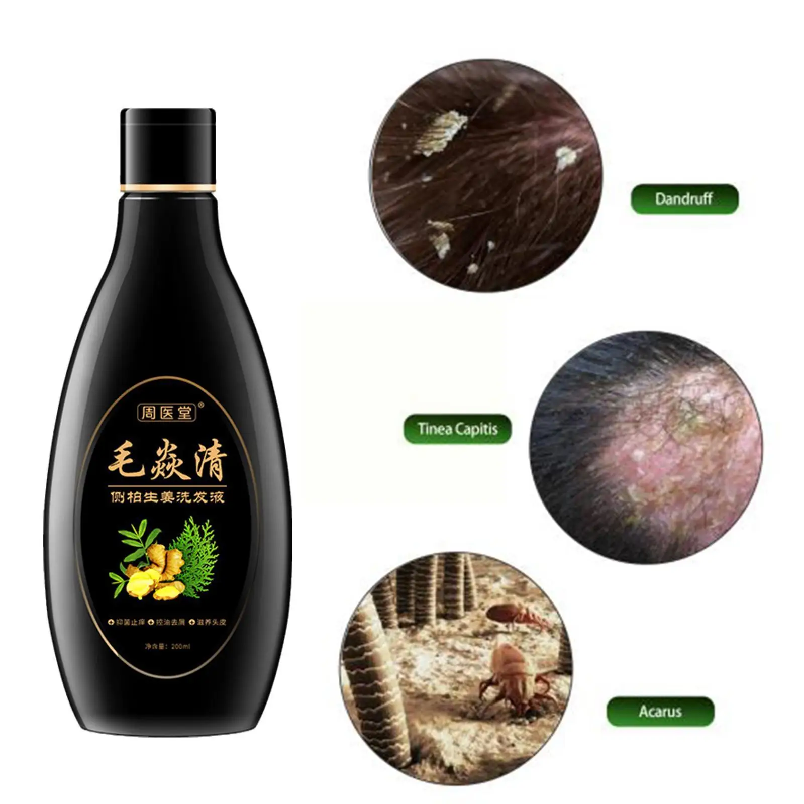 200ml Scalp Cleansing Shampoo Skincare Product Scalp New Anti-itching Shampoo Control Oil Psoriasis Follicle Hair Antibacte F5D2
200ml Scalp Cleansing Shampoo Skincare Product Scalp New Anti-itching Shampoo Control Oil Psoriasis Follicle Hair Antibacte F5D2