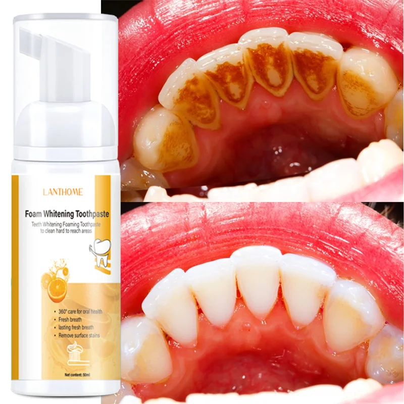 Teeth Whitening Mousse Deep Cleaning Cigarette Stains Whitening Teeth Plaque Stains Removal Remove Odor Oral Refreshing Care
Teeth Whitening Mousse Deep Cleaning Cigarette Stains Whitening Teeth Plaque Stains Removal Remove Odor Oral Refreshing Care