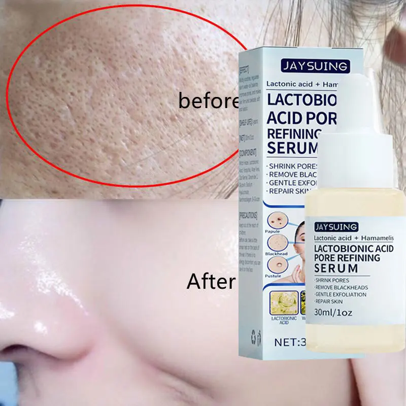 Lactobionic Acid Pores Serum Moisturizing Facial Essence Liquid Purify Shrink Pore Anti Aing Beauty Skin Care Korean Cosmetics
Lactobionic Acid Pores Serum Moisturizing Facial Essence Liquid Purify Shrink Pore Anti Aing Beauty Skin Care Korean Cosmetics
