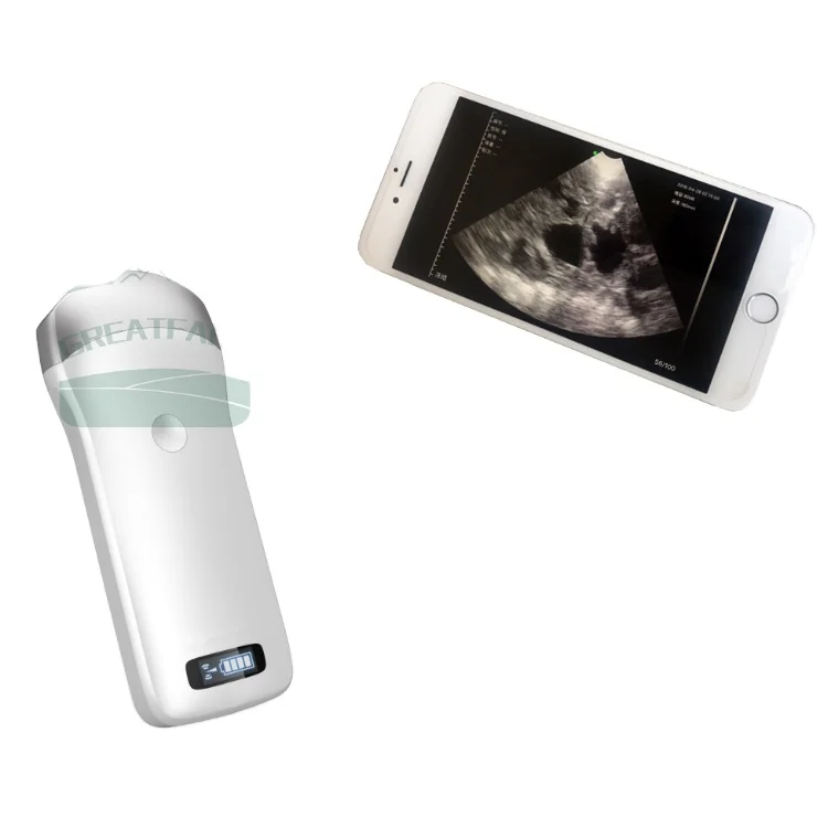 Portable veterinary ultrasound machine portable veterinary ultrasound equipment portable veterinary ultrasound
Portable veterinary ultrasound machine portable veterinary ultrasound equipment portable veterinary ultrasound