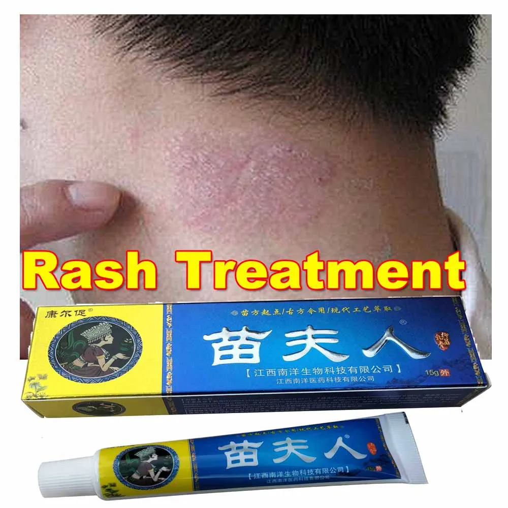

Treatment Psoriasis Ointment Natural Chinese Herbal Eczema Creams Dermatitis Pruritus Anti-Itch MFR