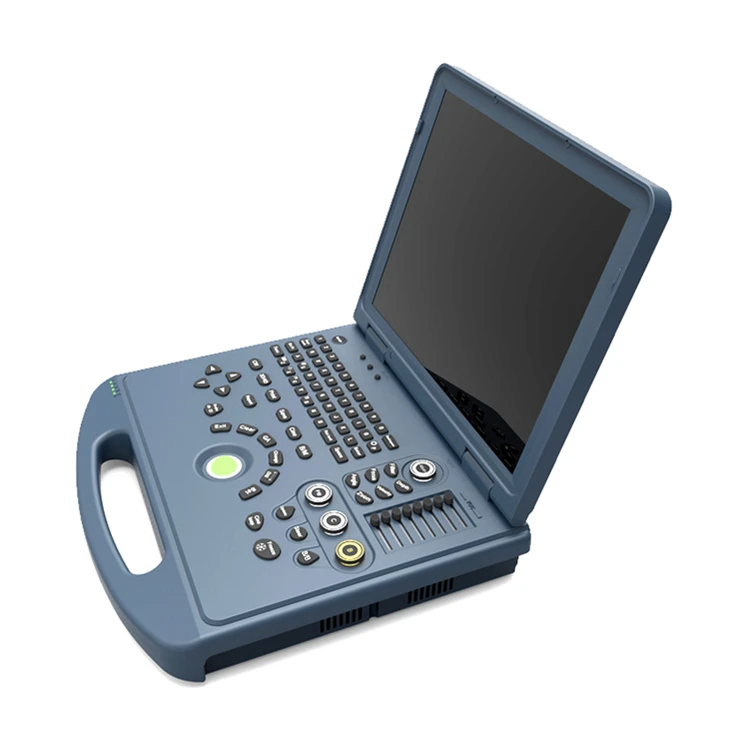 Color Ultrasound Portable Medical Ultrasound Instrument Doppler Ultrasound Machine
Color Ultrasound Portable Medical Ultrasound Instrument Doppler Ultrasound Machine