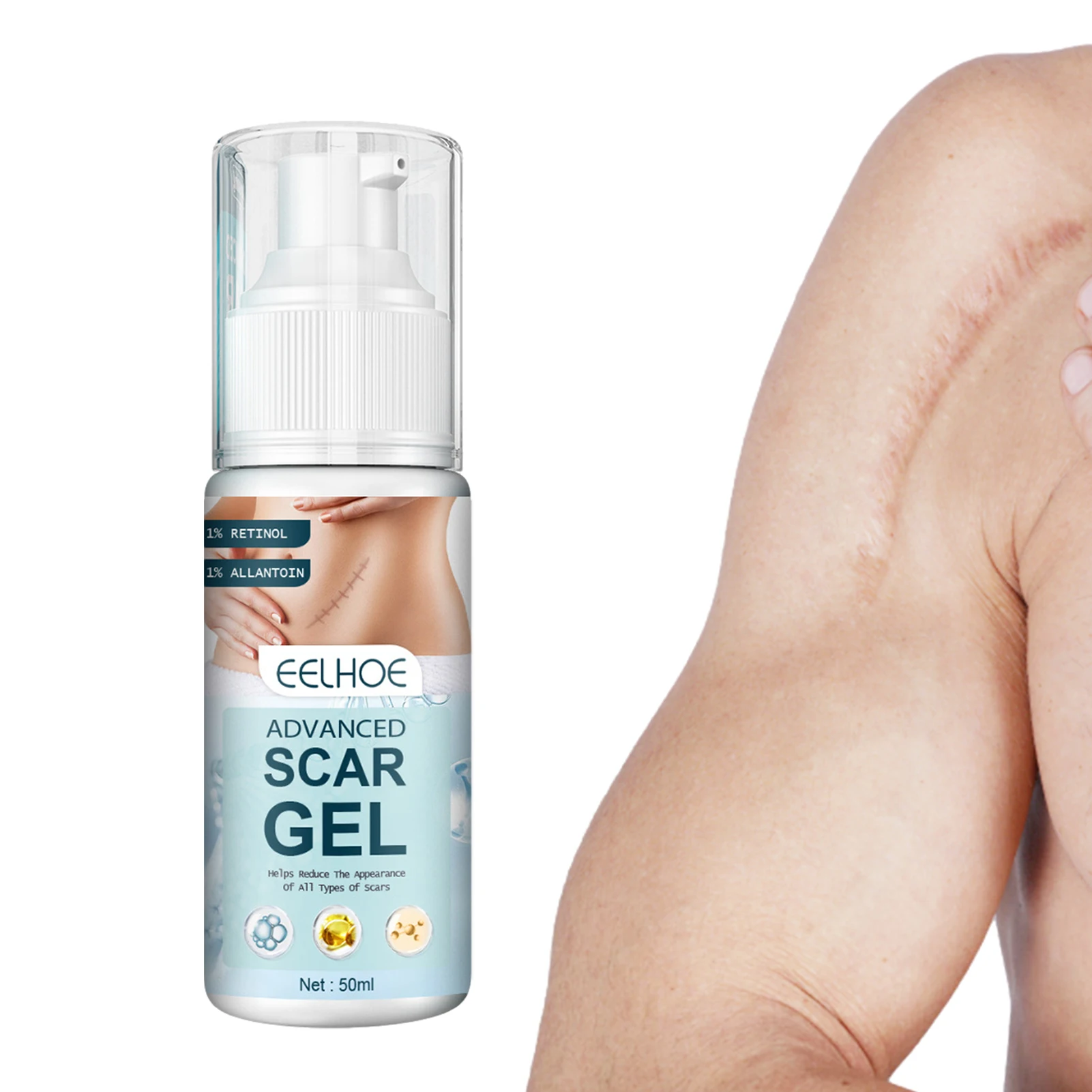 Scar Removal Gel Skin Care Stretch Marks Pimples Spots Repair Cream Whitening Moisturizing Smooth Beauty Cosmetics
Scar Removal Gel Skin Care Stretch Marks Pimples Spots Repair Cream Whitening Moisturizing Smooth Beauty Cosmetics