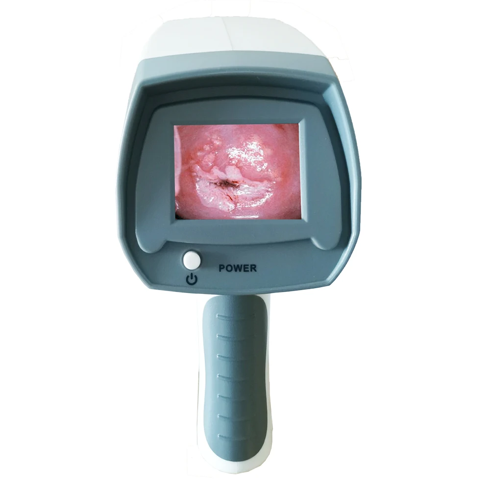 Для заводской цены, оборудование, электрическая система Colposcopy, цифровая Hd видео вагинальная камера для гинекологии
Для заводской цены, оборудование, электрическая система Colposcopy, цифровая Hd видео вагинальная камера для гинекологии