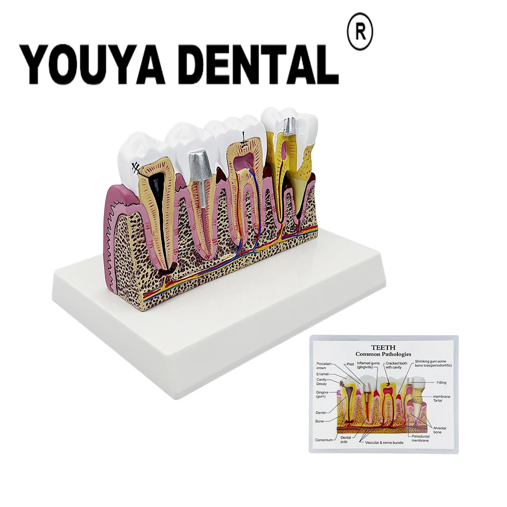 Dental Comprehensive Anatomical Model Teeth Teaching Model for Dentist Technician Student Studying Practice Studying 
Dental Comprehensive Anatomical Model Teeth Teaching Model for Dentist Technician Student Studying Practice Studying