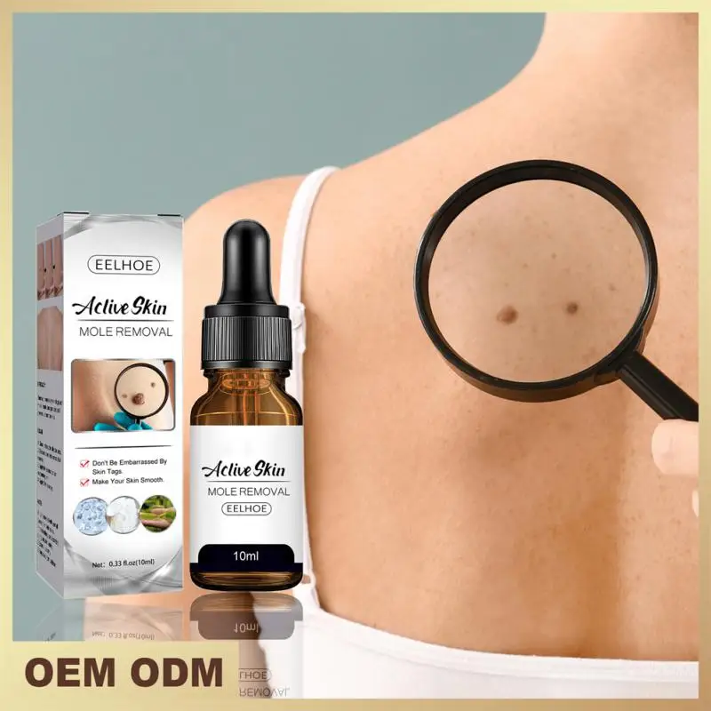 Wart Mole Removal Painless Fast Remover Serum Wart Tag Serum Skin Removal Mole Fast Remover Skin Care
Wart Mole Removal Painless Fast Remover Serum Wart Tag Serum Skin Removal Mole Fast Remover Skin Care