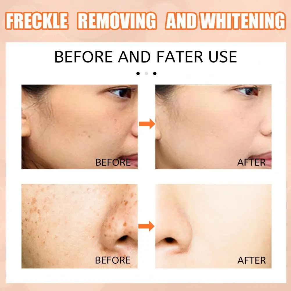 Wide Application 15ml Practical Whitening Freckle Cream Pen Compact Face Cream Shrink Pores for Female
Wide Application 15ml Practical Whitening Freckle Cream Pen Compact Face Cream Shrink Pores for Female