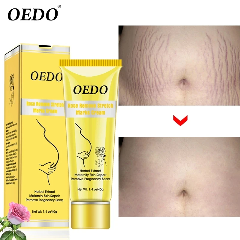 Rose Stretch Mark Removes Cream Postpartum Obesity Pregnant Women Repair Anti-Aging Winkles Remove Pregnancy Scars Body Cream
Rose Stretch Mark Removes Cream Postpartum Obesity Pregnant Women Repair Anti-Aging Winkles Remove Pregnancy Scars Body Cream