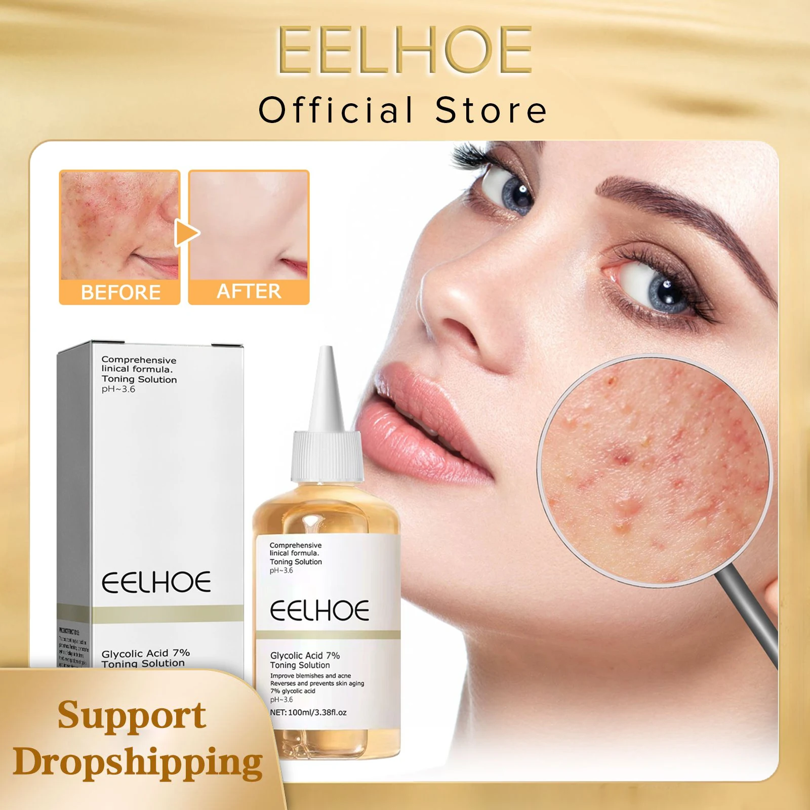 Moisturizing Whitening Glycolic Acid Shrink Pores Acne Pimple Repair Acne Scar Removing Lighten Anti Aging Soothing Serum Fluid
Moisturizing Whitening Glycolic Acid Shrink Pores Acne Pimple Repair Acne Scar Removing Lighten Anti Aging Soothing Serum Fluid