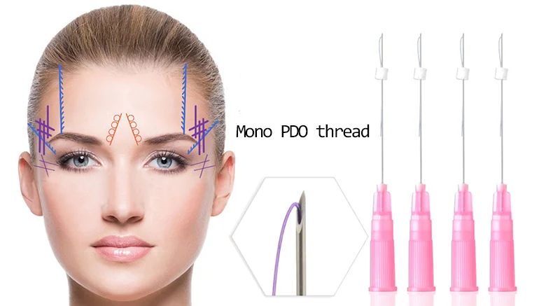Magik Thread Non Surgical consumubles suture cosmetic face lifting 4D 21G 100mm absorbable pdo thread
Magik Thread Non Surgical consumubles suture cosmetic face lifting 4D 21G 100mm absorbable pdo thread
