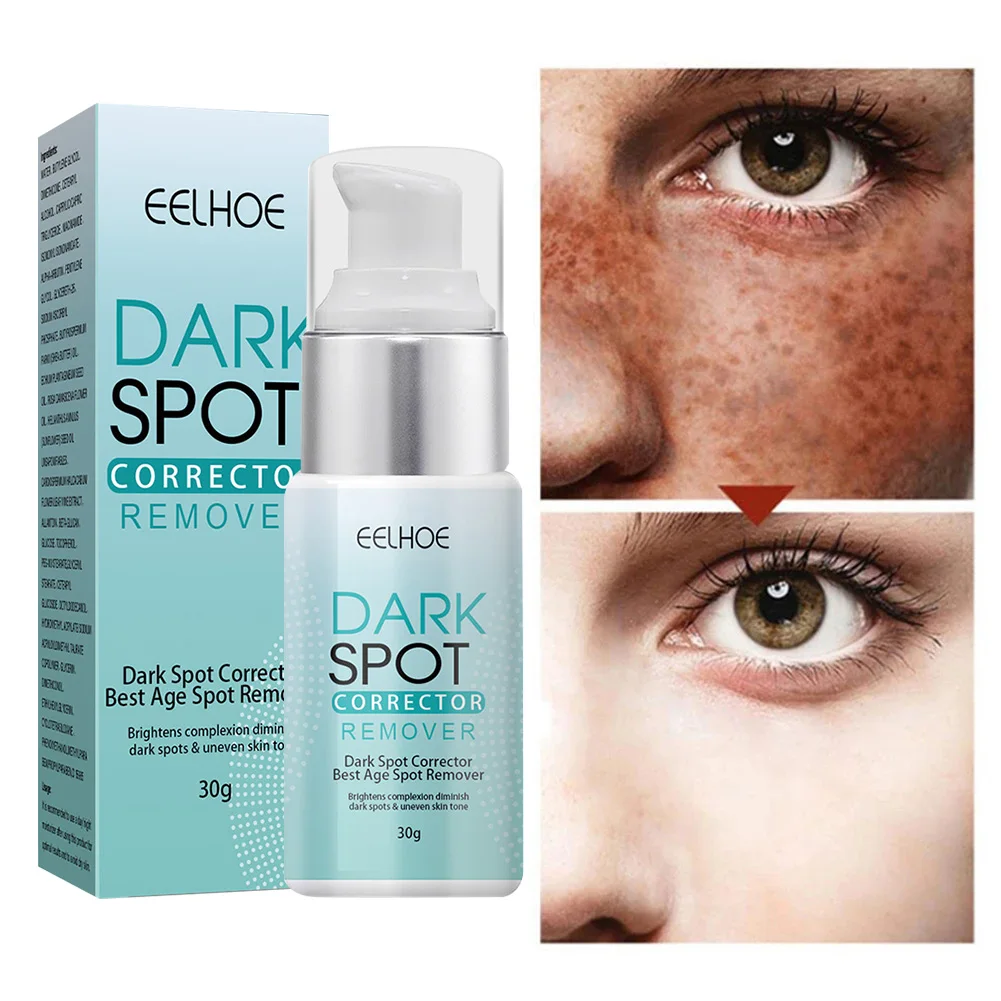 30g Whitening Freckle Cream Remove Dark Spots Melanin Even Skin Tone Dark Spot Corrector Skin Whitening Moisturizing Cream
30g Whitening Freckle Cream Remove Dark Spots Melanin Even Skin Tone Dark Spot Corrector Skin Whitening Moisturizing Cream