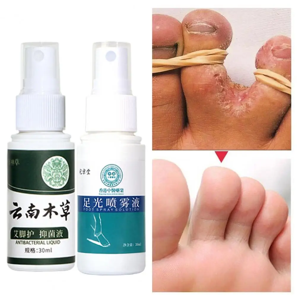Good Foot Cream Safe Unisex Herbal Athlete Foot Spray Foot-repair Antibacterial Foot Care Spray for Household
Good Foot Cream Safe Unisex Herbal Athlete Foot Spray Foot-repair Antibacterial Foot Care Spray for Household