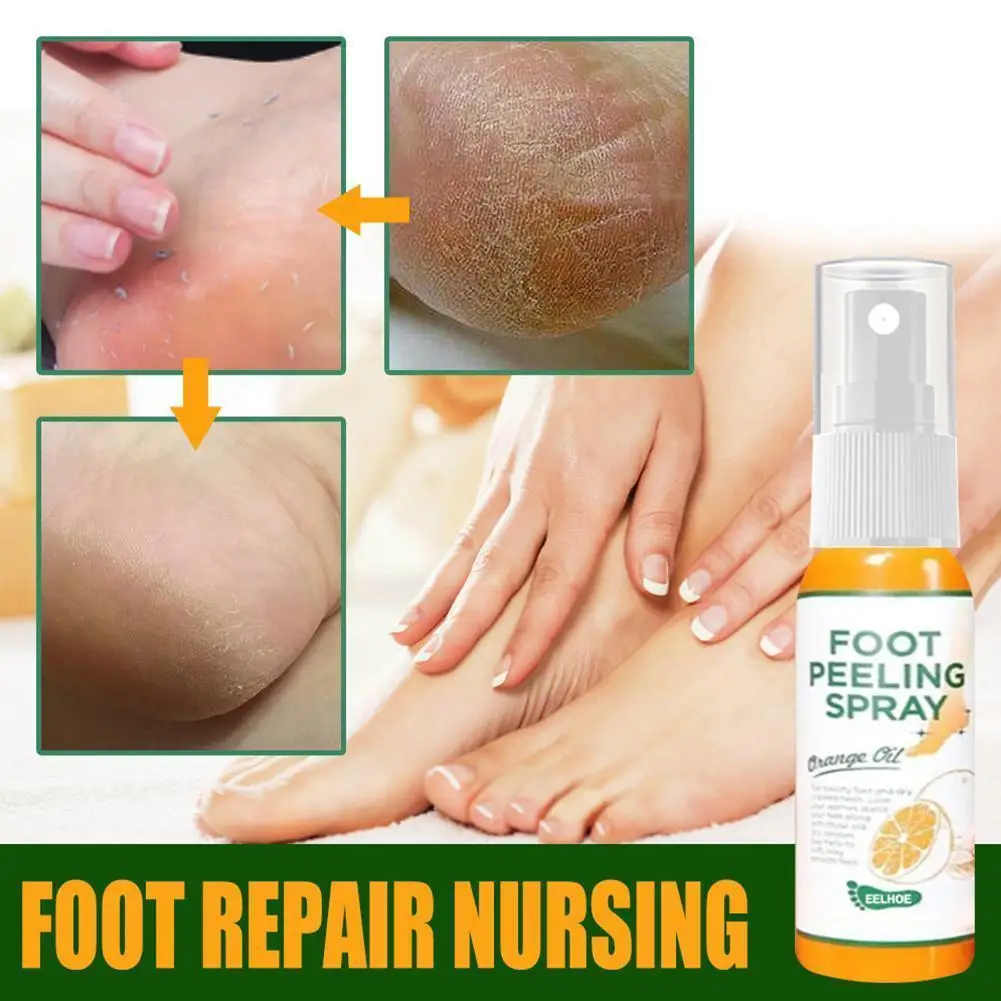 Foot Exfoliating Spray Can Remove Dead Skin On Feet, Remove Calluses Elbows And And Foot Knees, Care Crusty A9h2
Foot Exfoliating Spray Can Remove Dead Skin On Feet, Remove Calluses Elbows And And Foot Knees, Care Crusty A9h2
