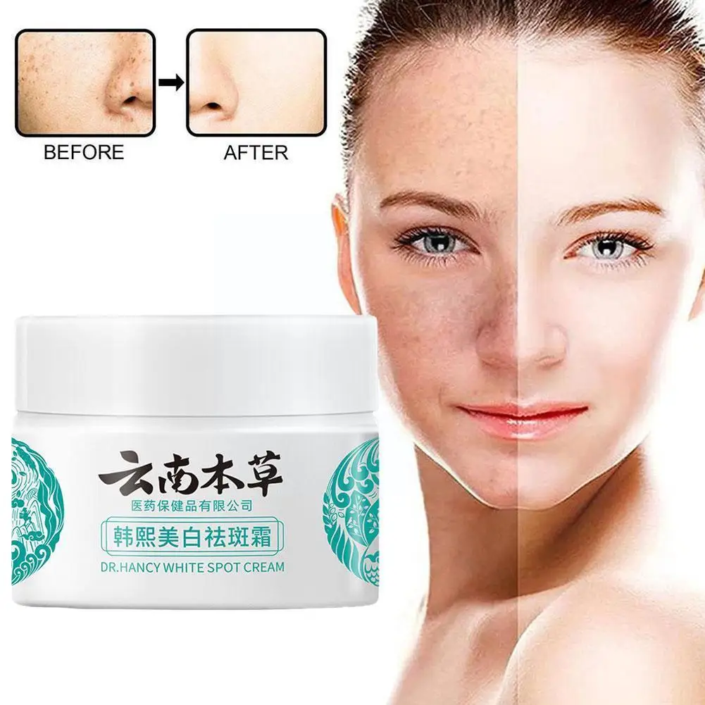 20g Yunnan Herb Powerful Whitening Freckle Cream Remove Skin Acne Spots Care Spots Beauty Dark Moisturizing Face Fa X1U6
20g Yunnan Herb Powerful Whitening Freckle Cream Remove Skin Acne Spots Care Spots Beauty Dark Moisturizing Face Fa X1U6