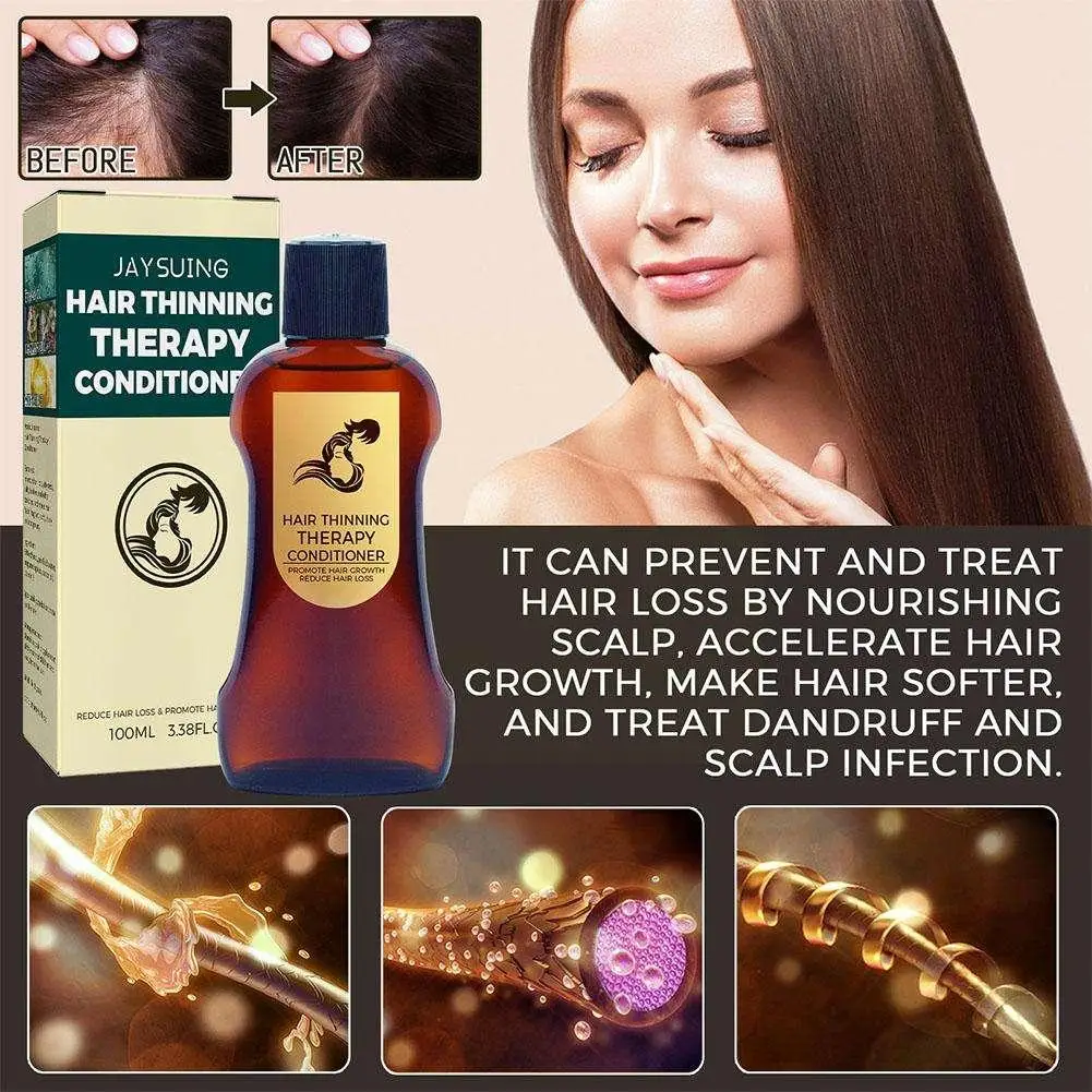 Powerful Hair Care Condition Hair Growth Hair Loss Products Essence Treatment For Men And Women Repair Hair Care 100ml E3o0
Powerful Hair Care Condition Hair Growth Hair Loss Products Essence Treatment For Men And Women Repair Hair Care 100ml E3o0