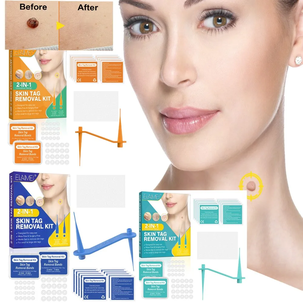 1 Set Blue Skin Tag Removal Kit Home Use Mole Wart Remover Equipment Micro Skin Tag Removeal Tool Easy To Clean Skin Care Tool
1 Set Blue Skin Tag Removal Kit Home Use Mole Wart Remover Equipment Micro Skin Tag Removeal Tool Easy To Clean Skin Care Tool