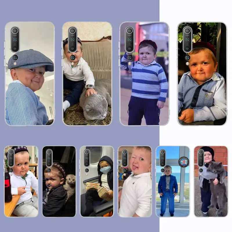 hasbulla funny cute boy Phone Case for Samsung S21 A10 for Redmi Note 7 9 for Huawei P30Pro Honor 8X 10i cover
hasbulla funny cute boy Phone Case for Samsung S21 A10 for Redmi Note 7 9 for Huawei P30Pro Honor 8X 10i cover