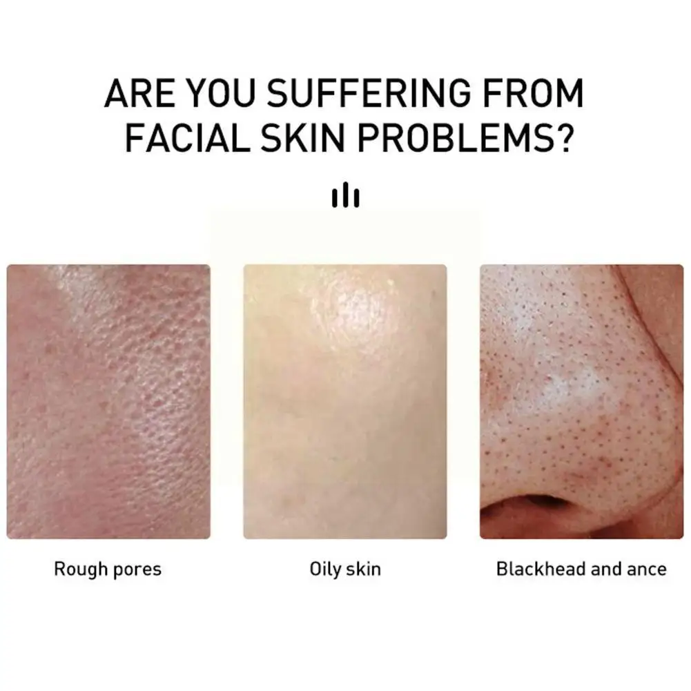 Salicylic Acid Acne Cream For Face Against Black Dots Acne Pimple Mark Remedy Removal Moisturizing Skin Care Cream Y0s0
Salicylic Acid Acne Cream For Face Against Black Dots Acne Pimple Mark Remedy Removal Moisturizing Skin Care Cream Y0s0